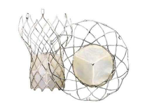 válvula transcatéter autoexpandible aórtica Vienna